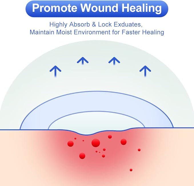 10 Count Hydrocolloid Bandages Large, 2" x 4" Hydrocolloid Wound Dressing Extra Thin for Light Exudate, Hydrocolloid Gel Bandages Fast Healing