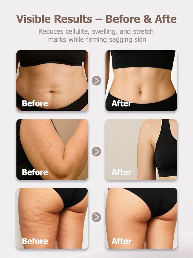 DiDEER Sciatica Pain Relief Devices, Deep Tissue Massager with Multi-Mode Technology,Heat & Light, Targeted Relief for Sciatic Nerve & Lower Back Pain