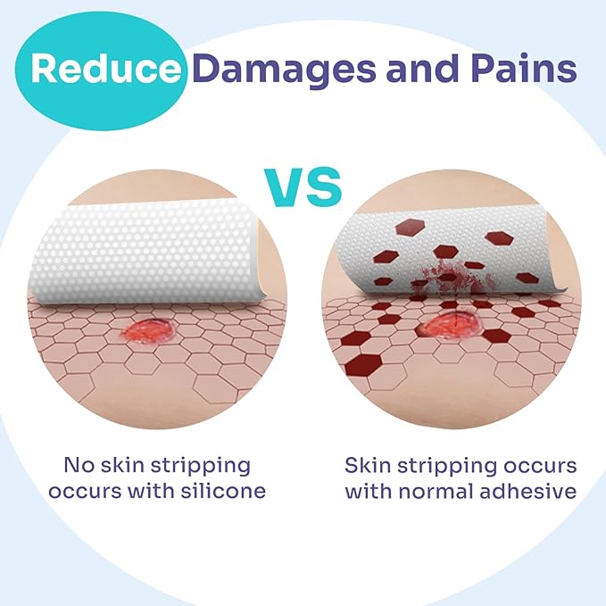 Conkote Silicone Foam Dressing Without Border 10 Pack, FSA or HSA 4"x4" Highly Absorbent Adhesive Wound Bandages for Post-Operative, Pressure Ulcers, Diabetic Foot Ulcers, Venous Leg Ulcers