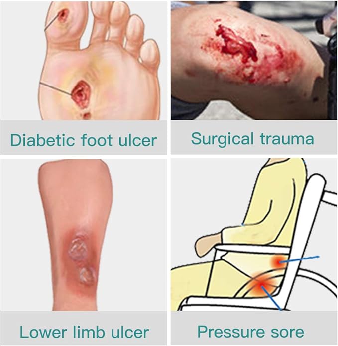 Dimora Calcium Alginate Wound Dressing, 4'' x 4'' Patches,10 Individual Sterile Pads, Soft and Highly Absorbent Dressing Gauze, Non-Stick Padding