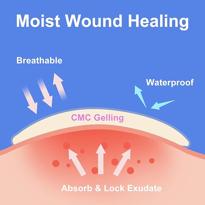 15 Count Hydrocolloid Bandages 4x4 in, Hydrocolloid Wound Dressing Healing Bandages for Wounds, Waterproof Wound Dressing Large