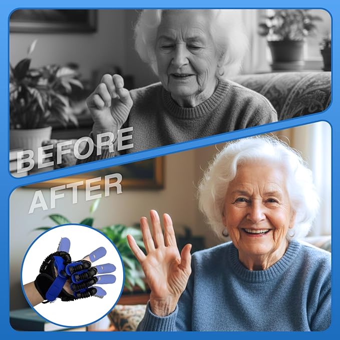 Hand Rehabilitation Equipment, Therapy Gloves for Stroke Hand Recovery Device, Robotic Rehab Glove for Finger Training, Adjustable Strength Hands Exerciser