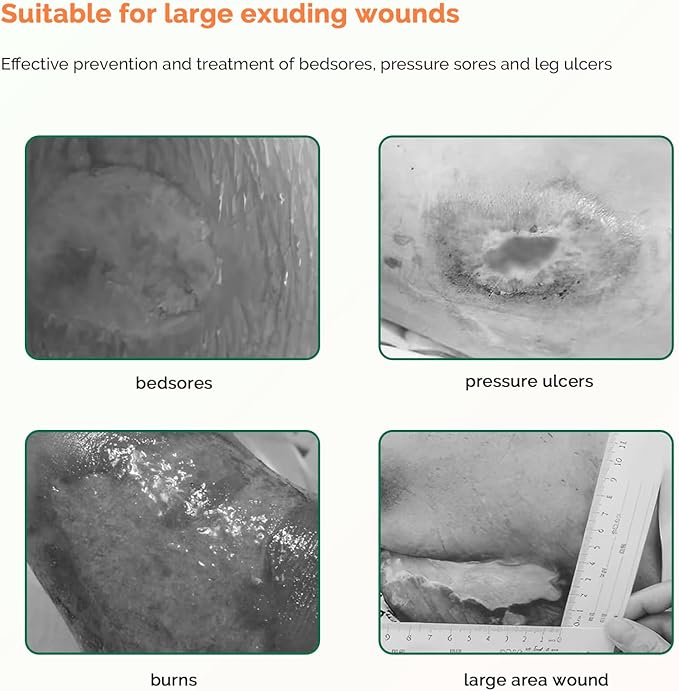 Sacrum Foam Dressing with Border - 10 Packs Silicone Adhesive 7"x7" Waterproof Sacral Wound Dressing - High Absorbent Pads Breathable Bed Sore Pressure Wound Care Bandages